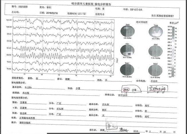 问止中医 | 医案：中医大脑挑战医学难题——儿童自闭症-第5张图片-天天中医网