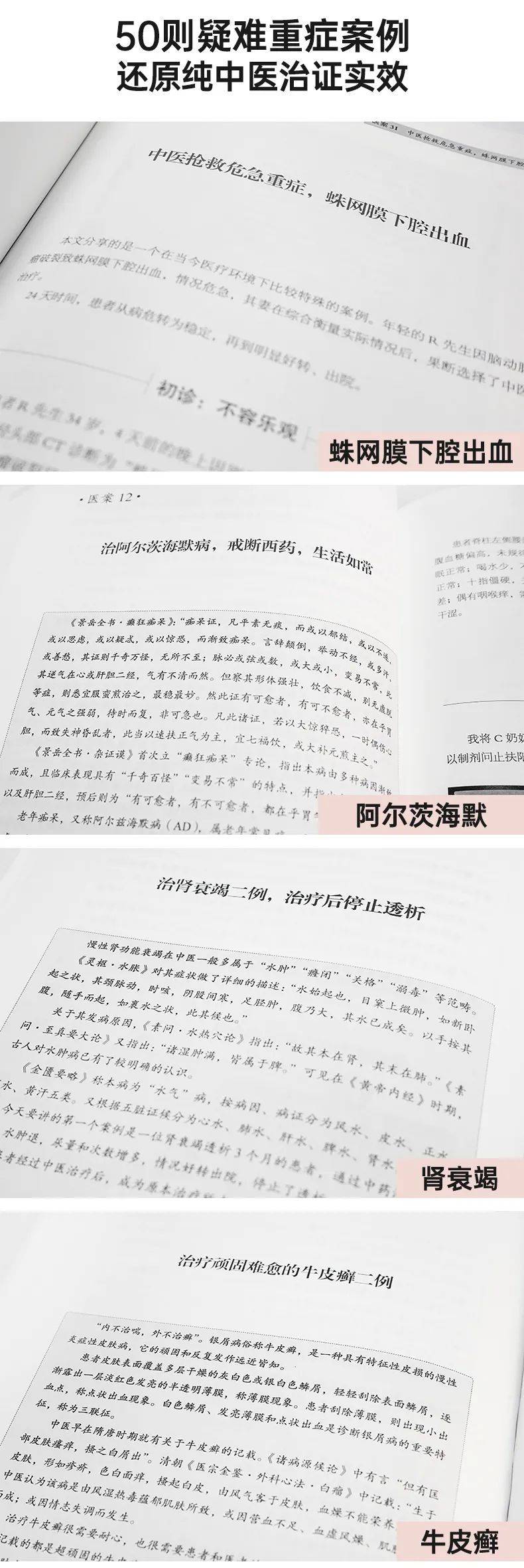 读书｜问止中医大脑诊治心法，尽在《AI岐黄·中医大脑疑难重症医案集》-第4张图片-天天中医网