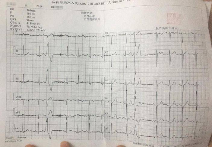 问止中医 | 医案：养心防猝死，治心慌、心悸、心律不齐案例-第4张图片-天天中医网